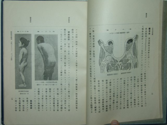 1928년 삼륜외과진찰.병법 외과적결핵 1책완질