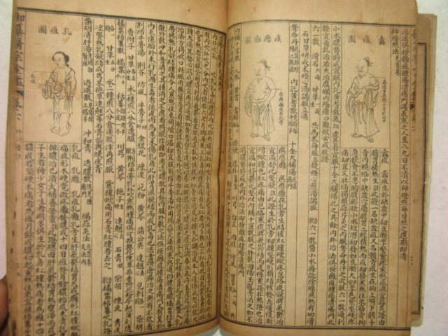중국 석판본 의종금감 2책