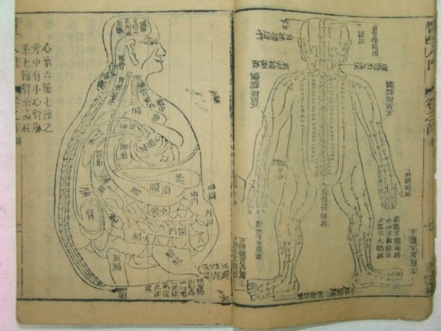 1892년(光緖壬辰)목판본 의학입문(醫學入門) 1책