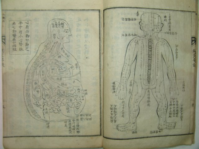 1925년 유성룡(柳成龍) 침구요결(鍼灸要訣) 1책완질