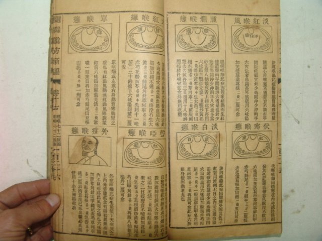 1897년 증보험방신편(增補驗方新編) 18권1책완질