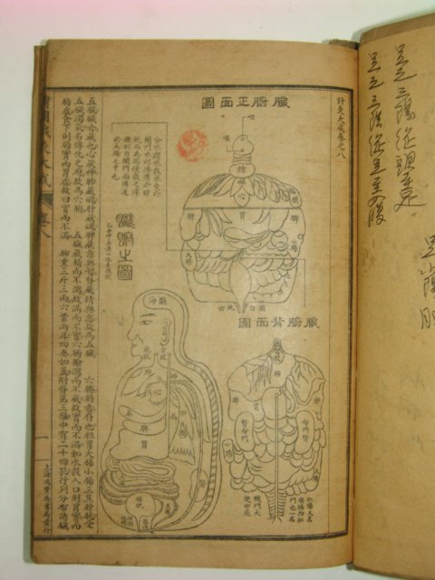 중국석판본 침구대성(針灸大成)권8~12 1책