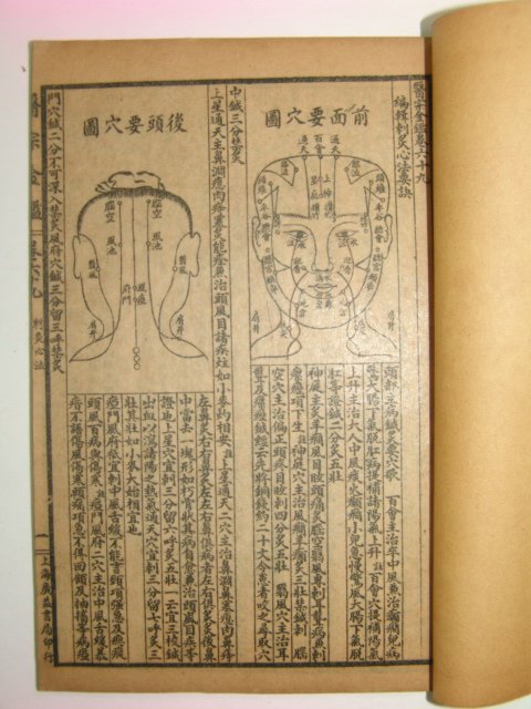 중국석판본 의서 교정의종금감(校正醫宗金鑑) 14책