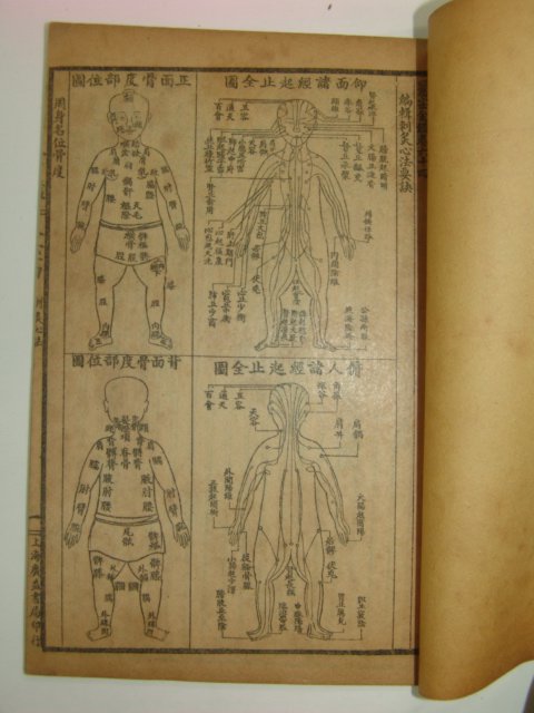 중국석판본 의서 교정의종금감(校正醫宗金鑑) 14책