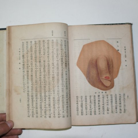 1917년 국한문혼용 의서 의방강요(醫方綱要) 1책완질