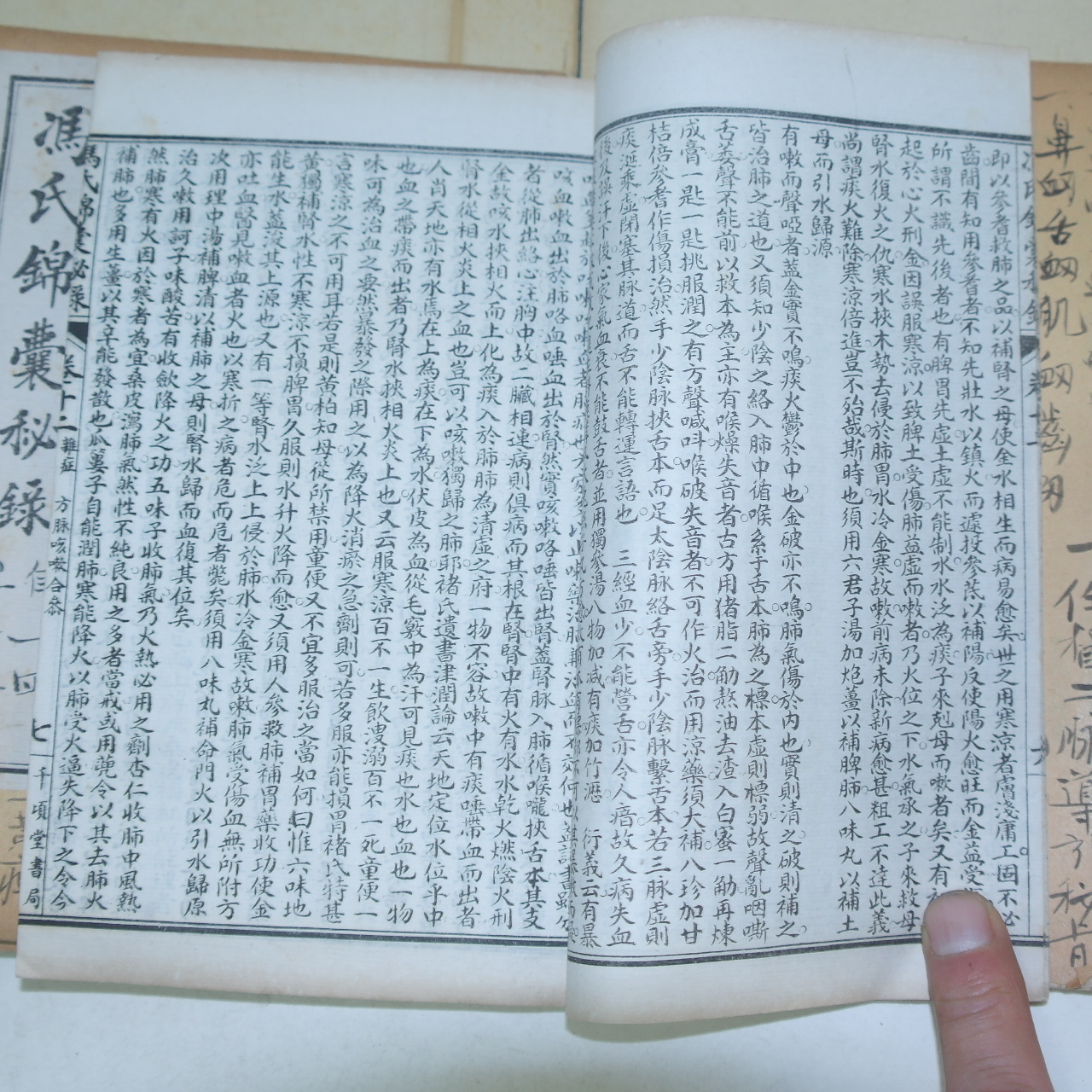 중국본 의서 소아편 풍씨금양비록(馮氏錦襄秘錄)권11~20 6책
