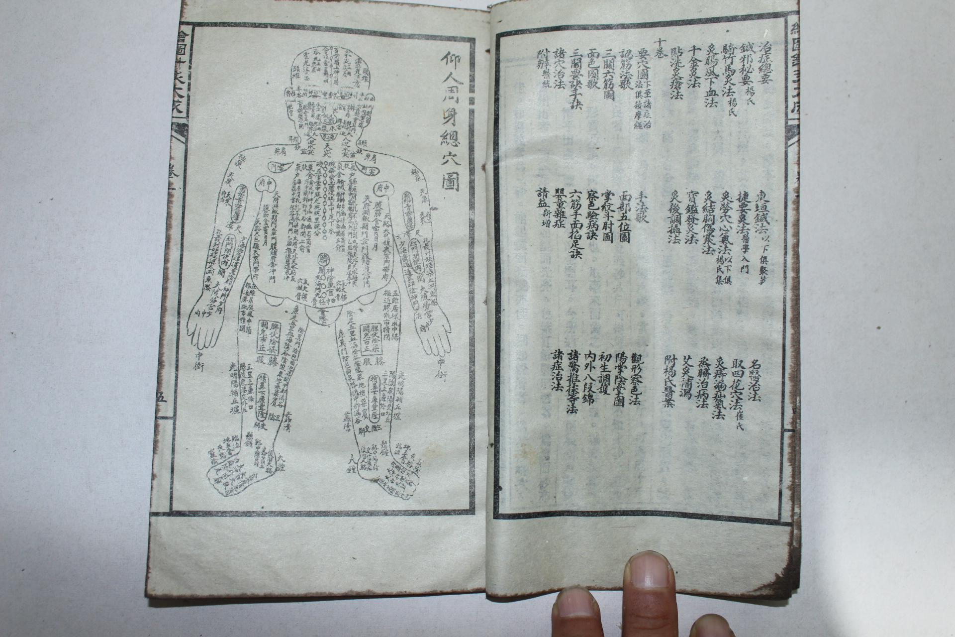 중국석판본 의서 회도침구대성(繪圖針灸大成) 17책완질