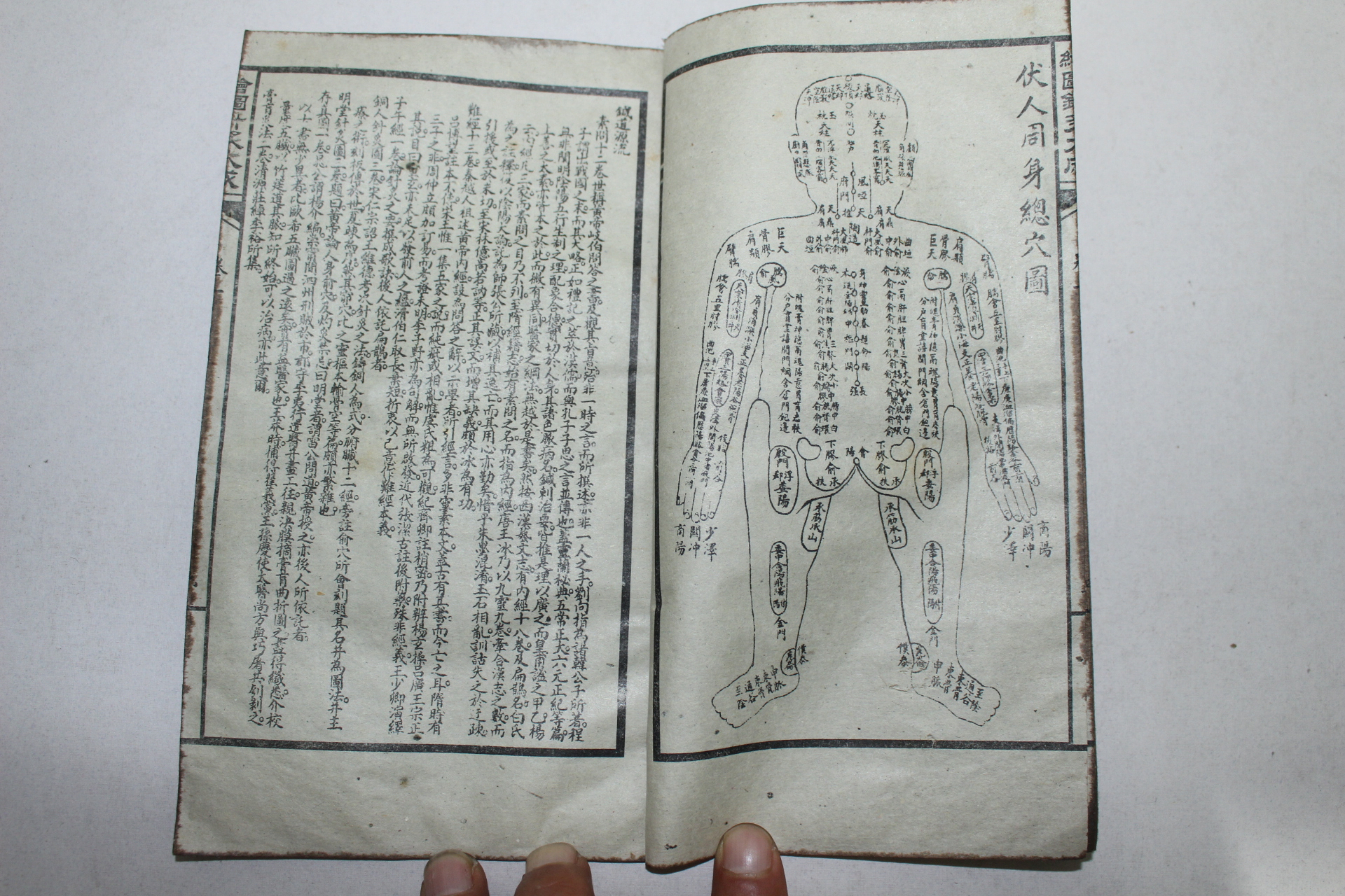 중국석판본 의서 회도침구대성(繪圖針灸大成) 17책완질