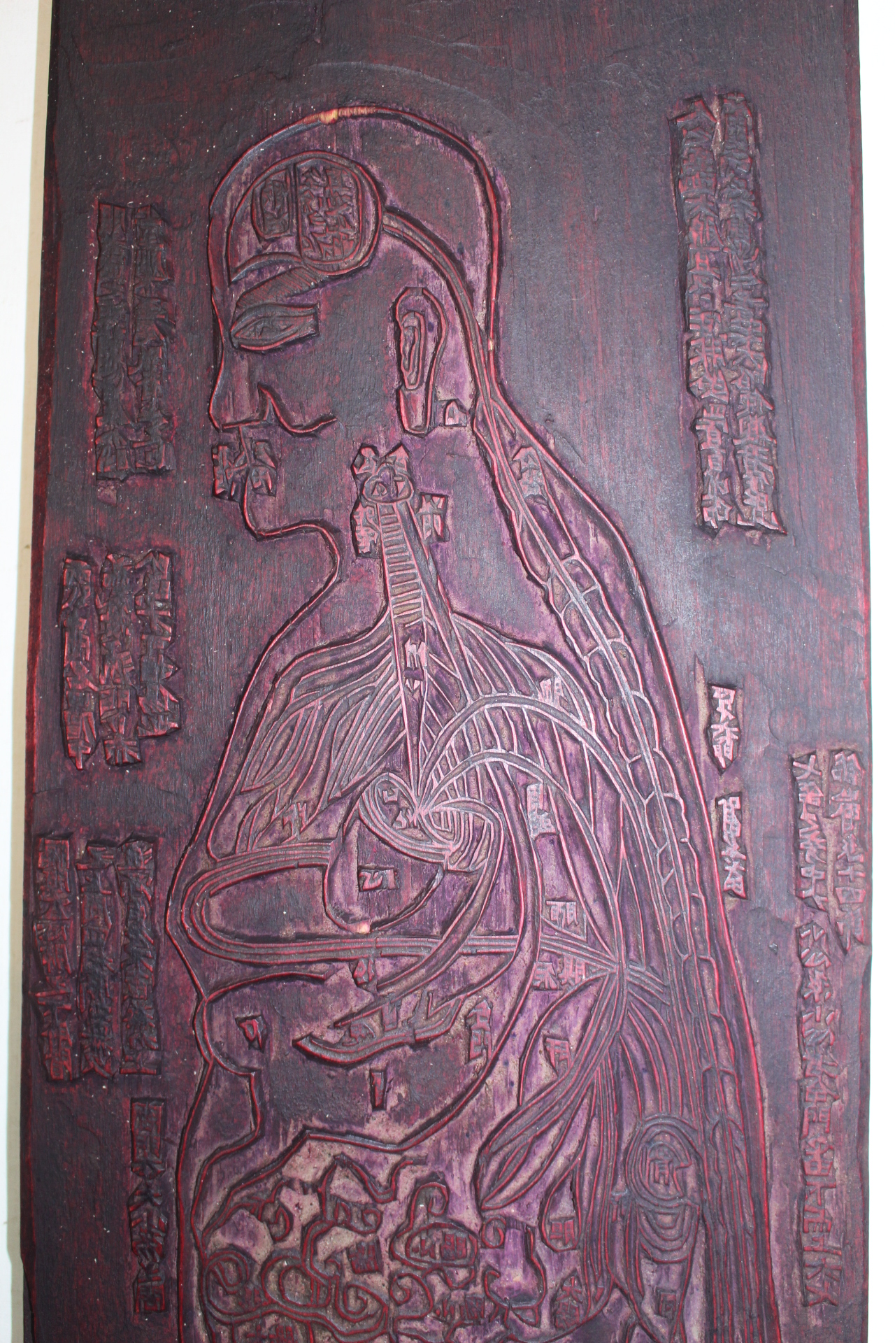 조선시대 침구경혈도(鍼灸經穴圖) 목판
