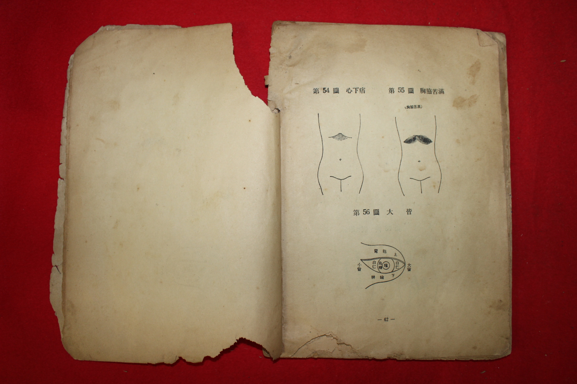 1965년 종합 침구학(針灸學)