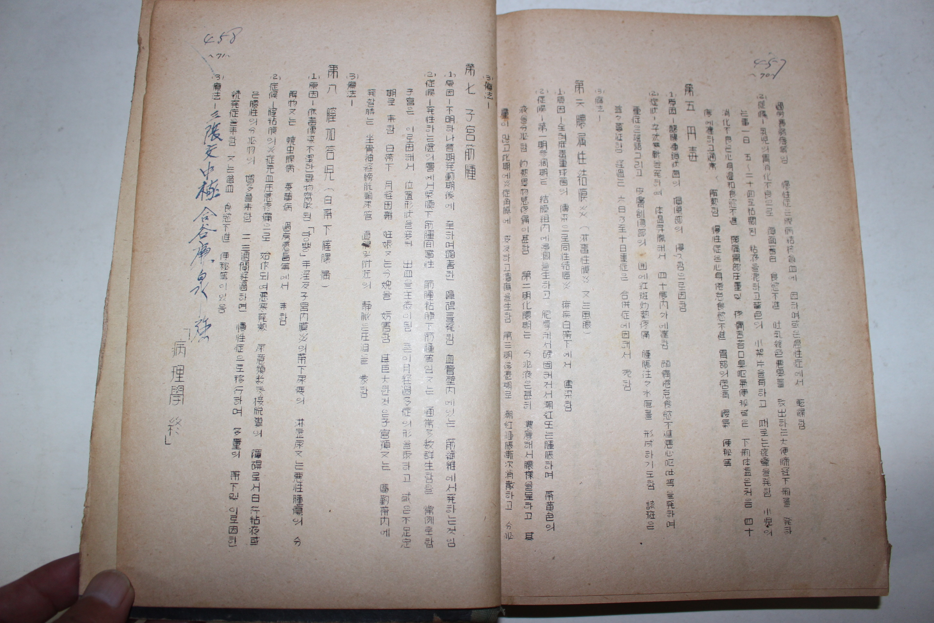 1950년대 철필본 의서 침구총론(鍼灸總論) 합본 1책완질