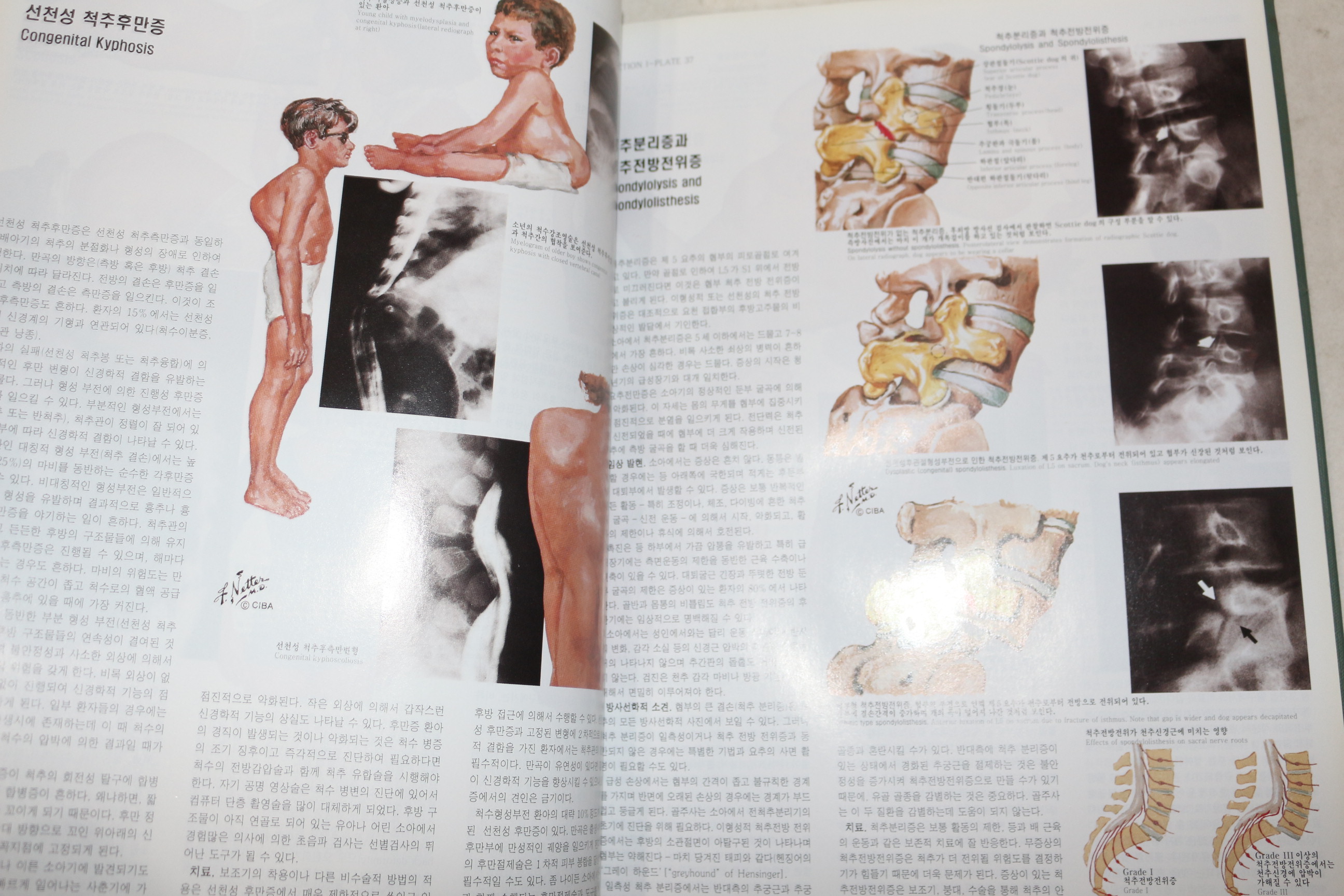 2000년 CIBA 원색도해의학총서 근골격계 2